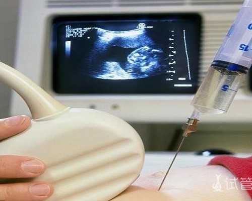 国内代孕机构价格,皮肤差吃避孕药真有作用，你都想象不到还有这些附加功效