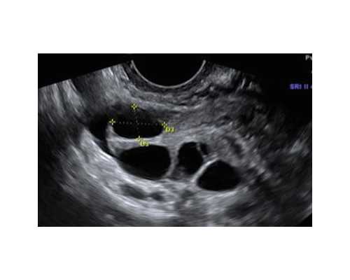 国内供卵试管合同,邵阳中心医院可以做试管吗一起来看看