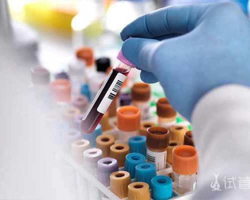 国内哪里可以供卵做试管的,做试管应该选择怎样的医院