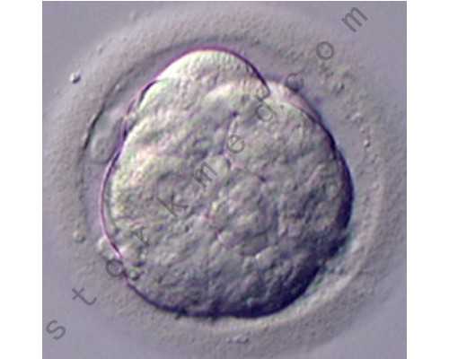 全国供卵医院排名前十名,输卵管内积水会导致的症状？还能做试管吗？