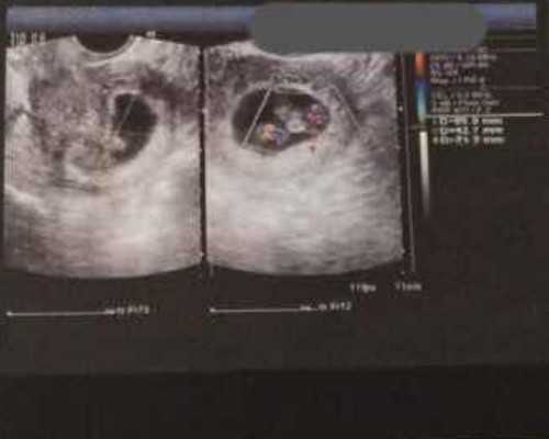 国内供卵借卵代生,最新吉林1家试管婴儿医院排名、哪家*率最高