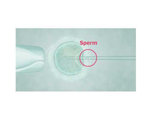 国内供卵试管民营医院哪家好,年轻女子不孕不育是什么原因 不孕知识：宫颈炎与女性不孕