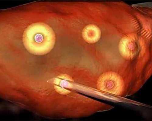 国内有代怀生小孩,在泰国做试管婴儿全流程需要多少费用