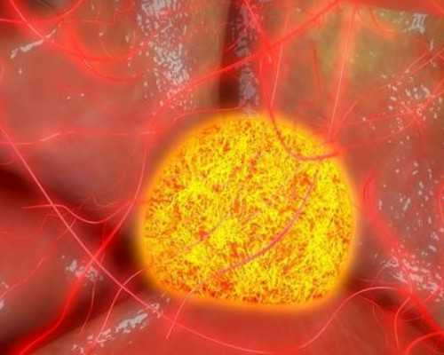 国内私人试管代孕公司,高泌乳素血症的症状有哪些？高泌乳素血症有哪些表现？