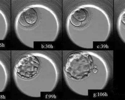 中国供卵试管婴儿医院,邵阳市汇恩医院做试管*率 从这些维度来看待很重要