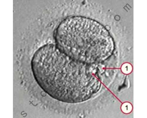 国内供精供卵选性别公司,试管婴儿失败后有哪些症状？附失败后的应对方法